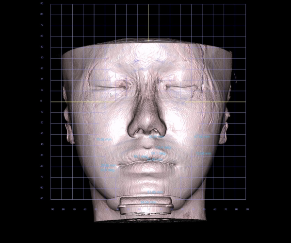3D AI 안면분석 이미지