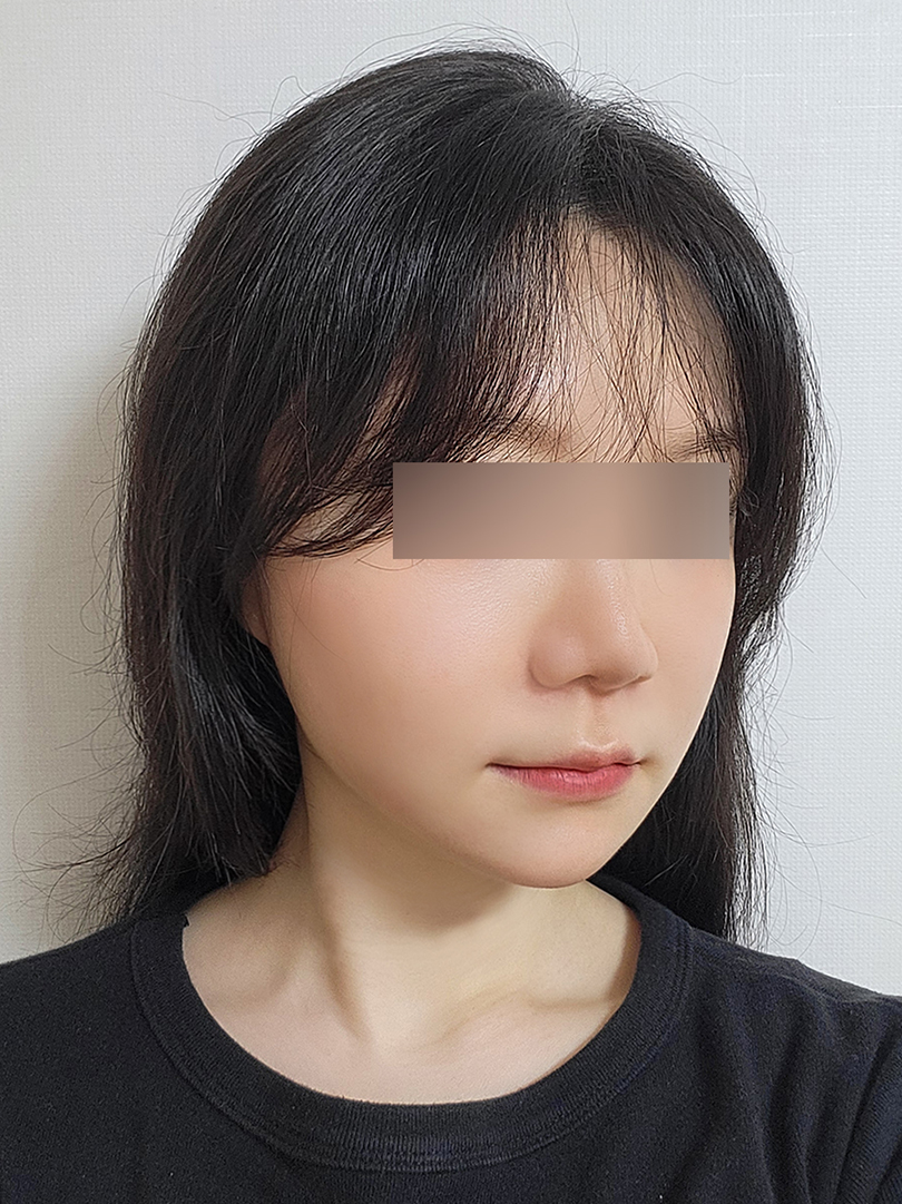 맥스구강악안면외과 리얼후기