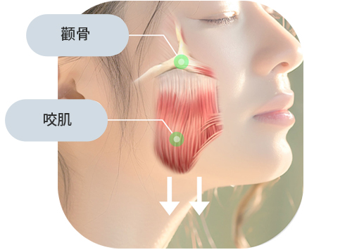 V-Line手术