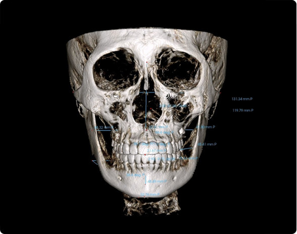 3D AI 안면분석