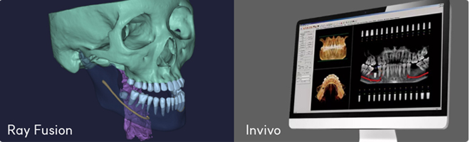 맥스 3D AI 분석 프로그램