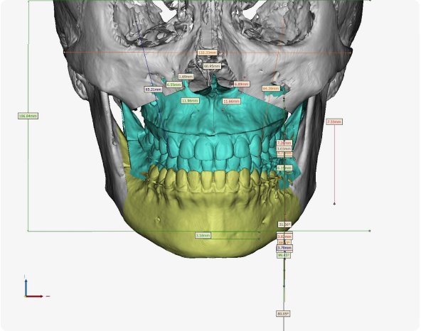 3D 프린팅LAB