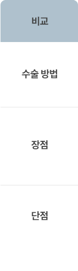 선교정 vs 선수술 vs 조기수술 비교분석
