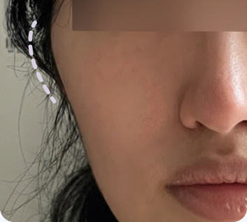 얼굴형에 대한 다양한 고민들 맥스가 해답