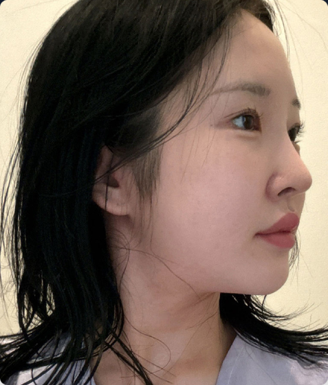 전후사진