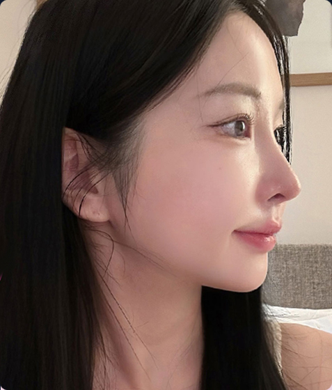 전후사진