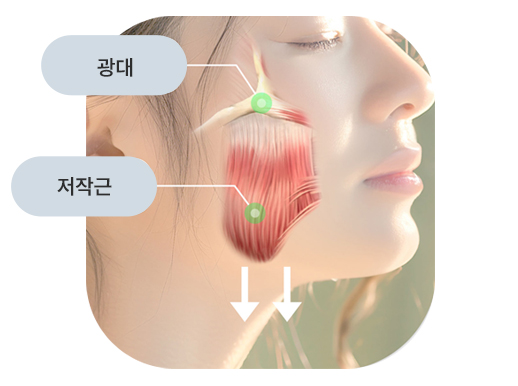 브이라인 수술!