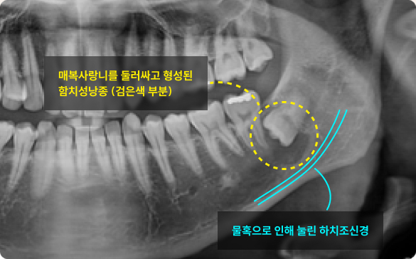 맥스구강악안면외과 치과의원